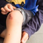How to Manage Skinned Knees