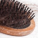 Is Your Hair Falling Out?